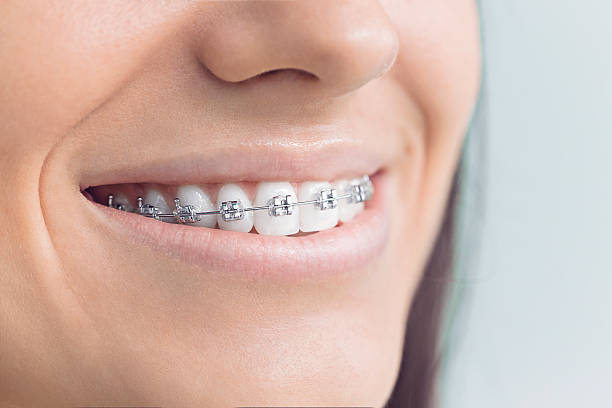 Best Invisalign and Clear Aligners  in Lakeview, WA